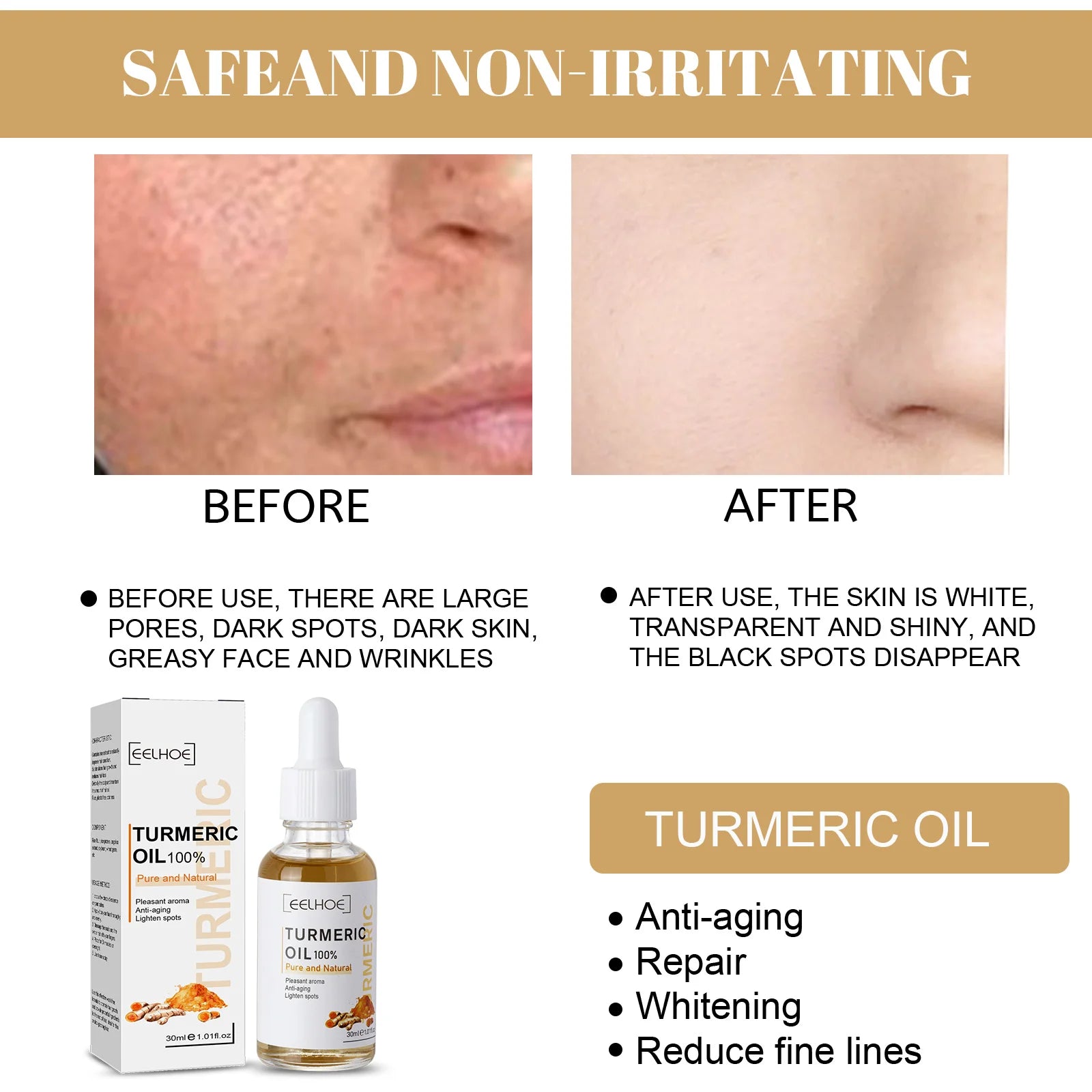 Eelhoe Turmeric Dark Spot Correction Serum Improves Skin Tone Black Spots Dark Fine Lines Serum Facial Moisturizing Hydrating