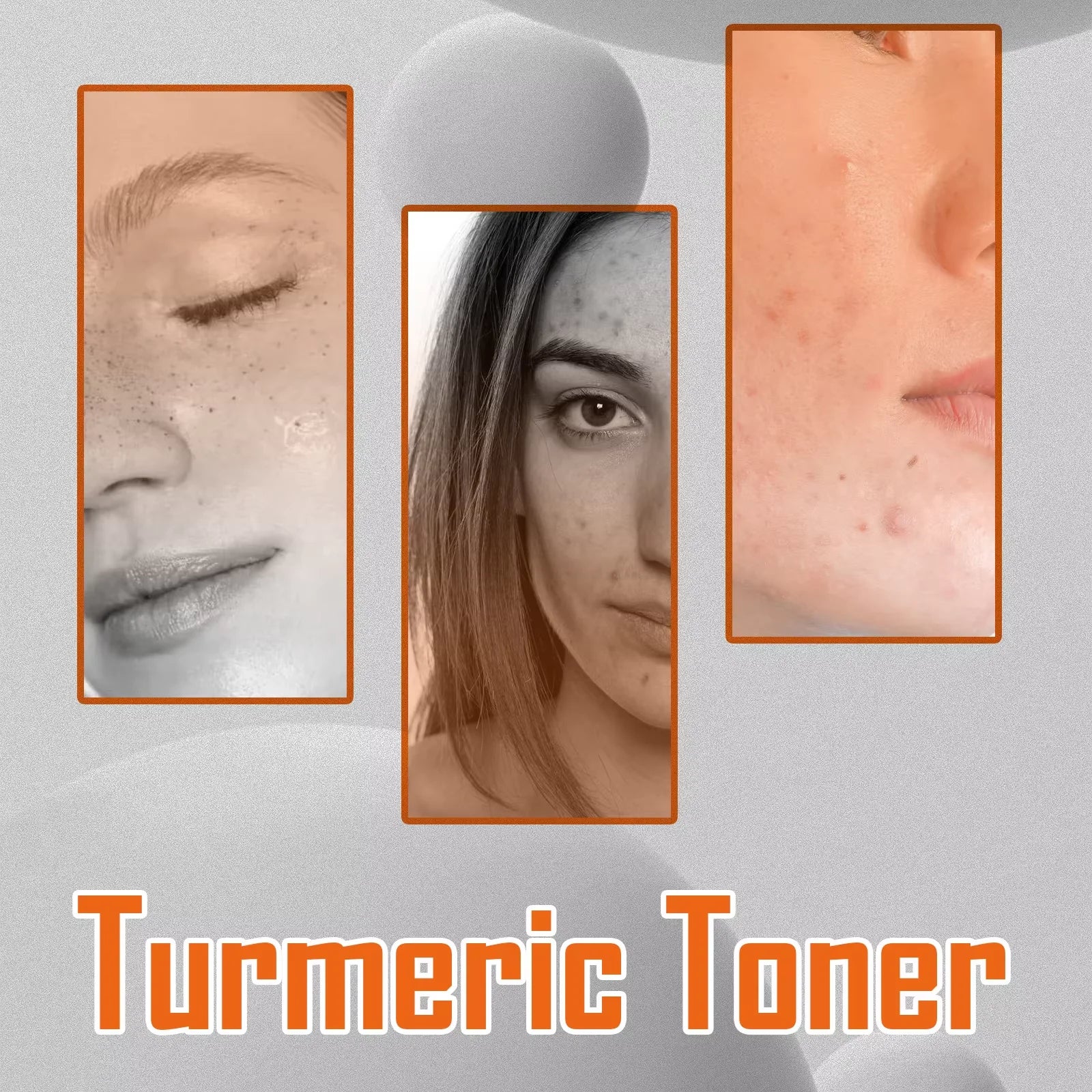 West&Month 100ml Dark Spots Removal Toner Turmeric Deep Hydration Lighten Melasma Remove Freckle Moisturizing Facial Skin Toner