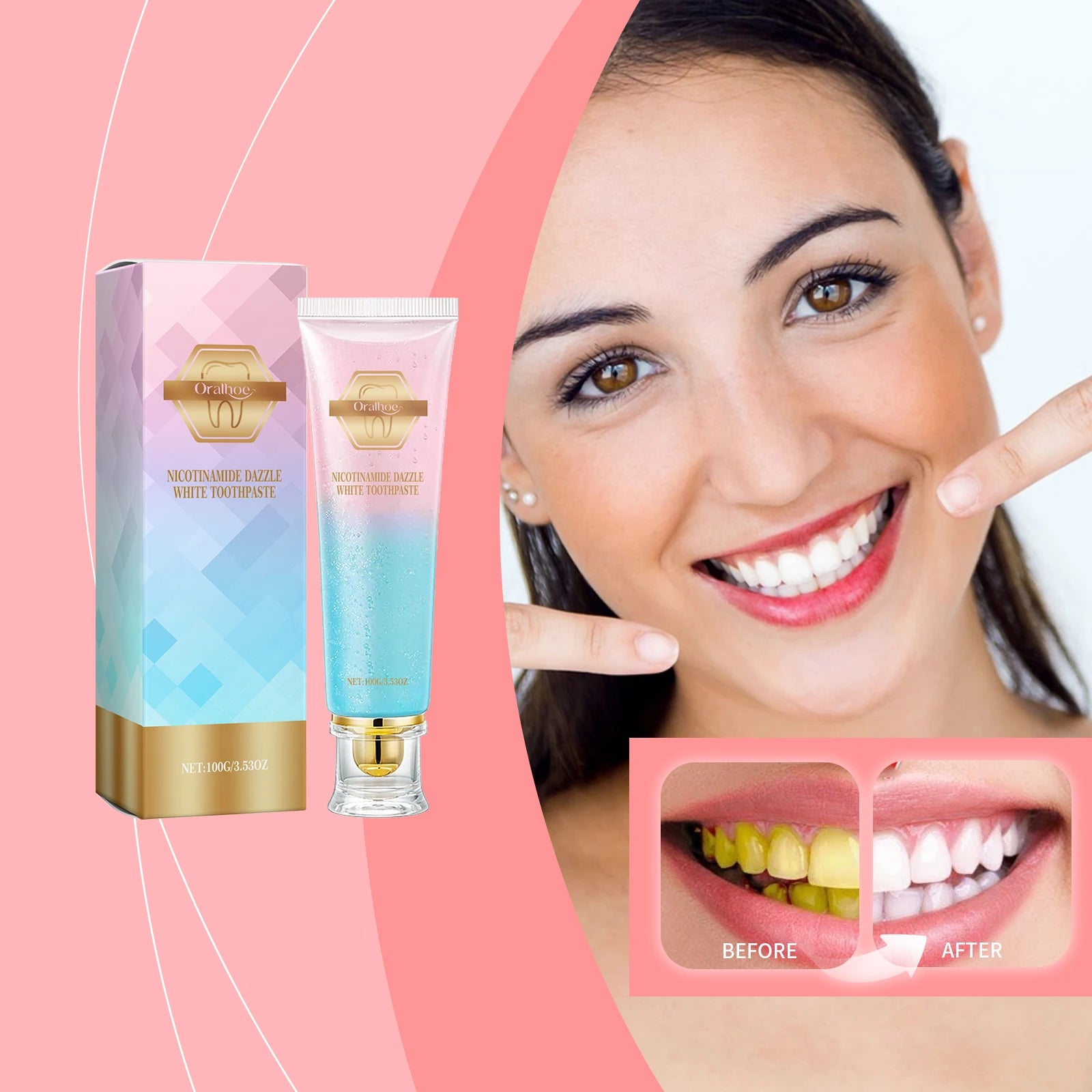 Oralhoe Niacinamide Toothpaste Remove Plaque Gentle Soothing Gum Stains Brightening Teeth Oral Deodorant Mint Dental Cleaning