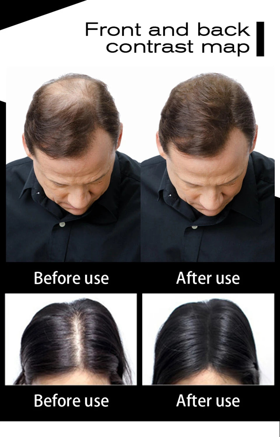 Sevich Refill Bag 100g Hair Fiber Hair loss products bald extension thicken Hair building fibers 10 colours hair growth powder