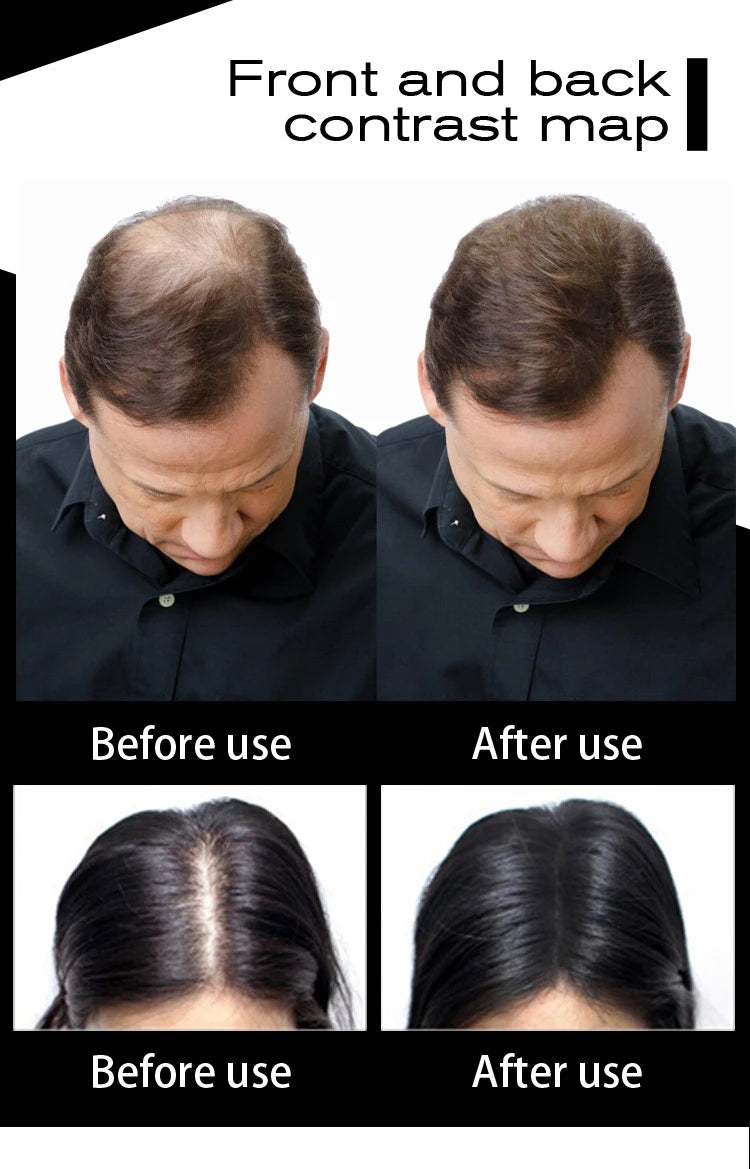 Sevich 10 colors hair fiber thicken powder 100g refill bag hair loss products hair building fibers powders
