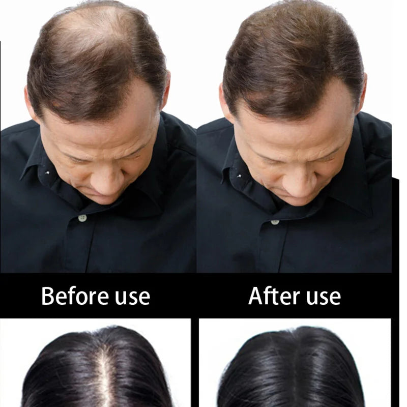 Beauty Salon Instant Thickening Hair Fiber Powder Thickening Hair Fibers Building Wig Extensions Refill Black Colors 100g