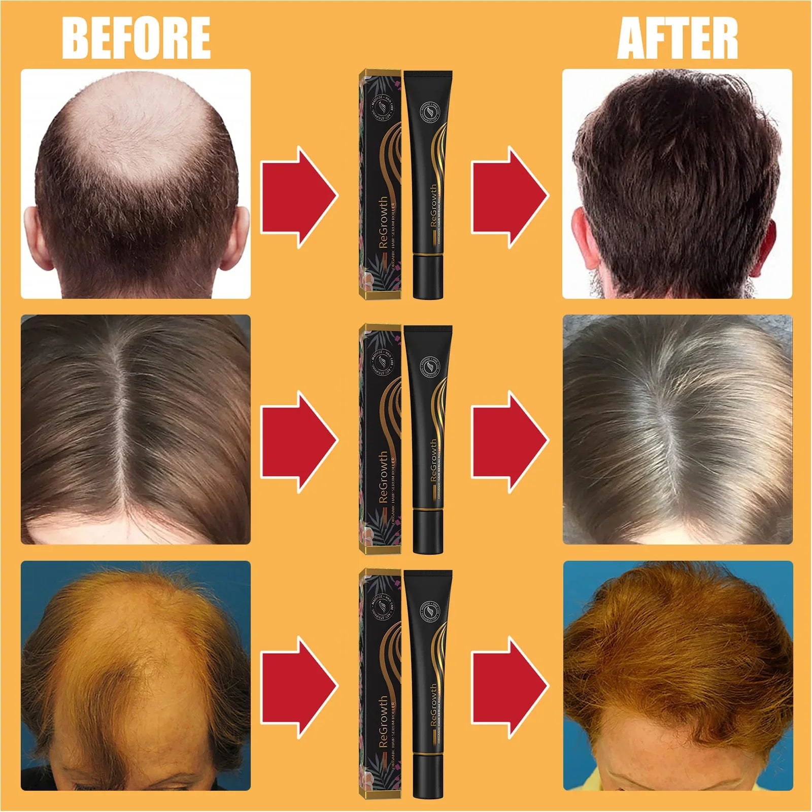 Africa Crazy Hair Edges Growth Traction Alopecia Chebe Powder Thicken Grow Long Hair Shampoo Hair Loss Treatment Wildly Beauty