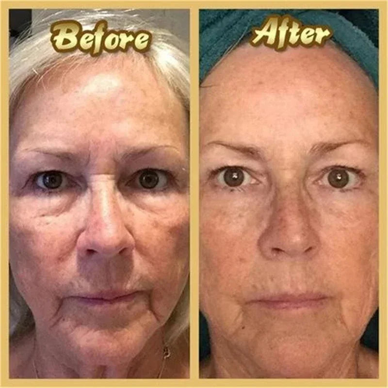 2pc Collagen Estrogen Female Hormones Oil,Remove Spots Wrinkle Eye Bags Anti-Aging,Breast Butt Enlargement,Skin Care for Women
