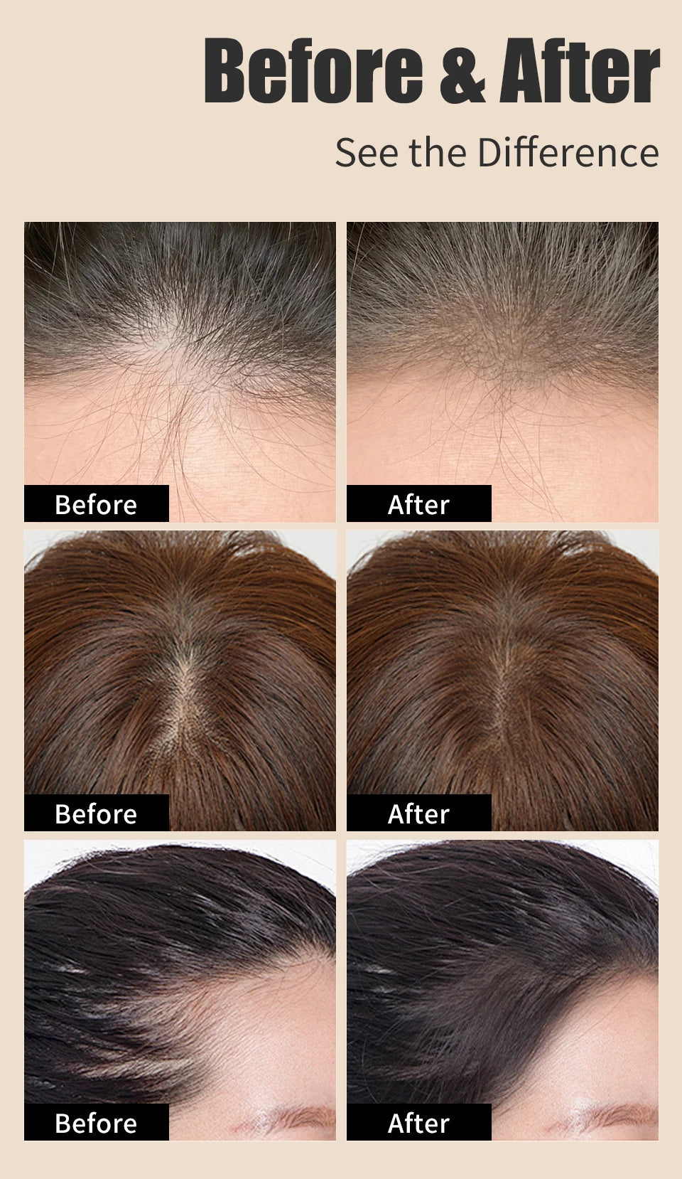 Sevich Hairline Powder Instantly Conceals Hair Loss Root Touch Up Powder Hair Loss Cover Up Hair Shadow Powder Black Hair Fibers
