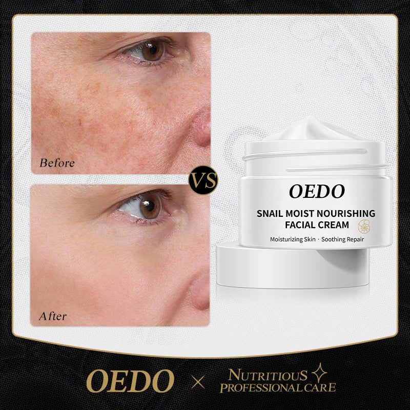 OEDO Anti-aging Face Cream Snail Face Cream Anti-wrinkle Lightening Wrinkles Whitening Moisturizing Face Nourishing Skin Care