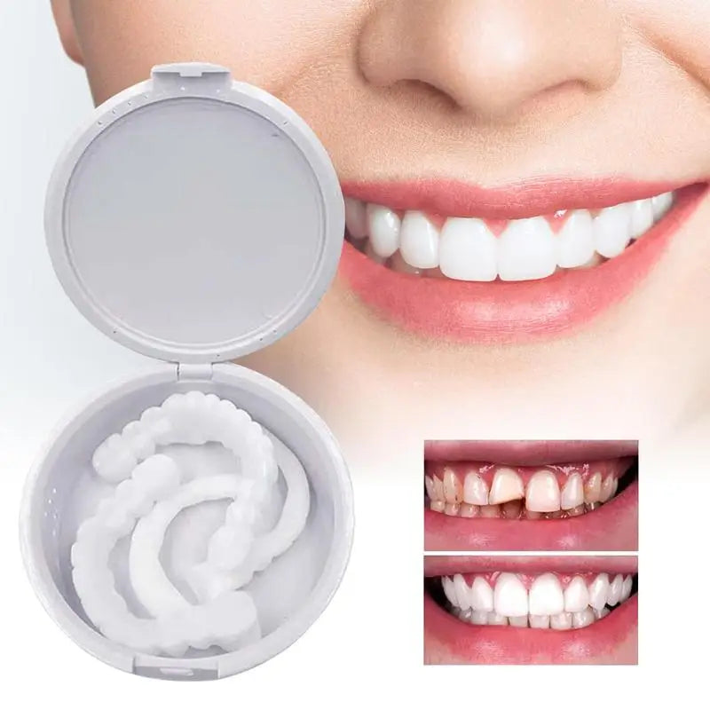 Veneer Snap On Teeth Kit Fake Tooth Cover Snap On,Teeth Fake Teeth Simulation Braces Veneers Dentures Cosmetic Fake Tooth Cover