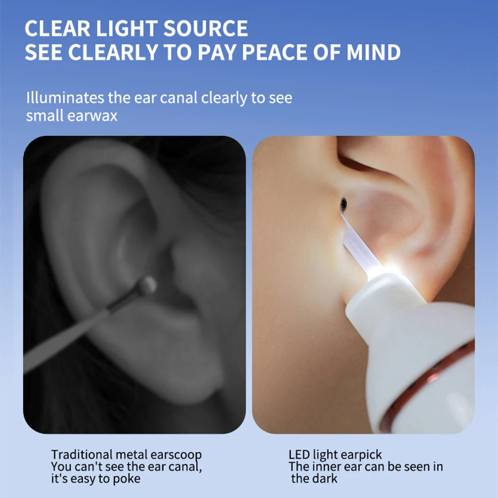 Electric Vacuum Ear Wax Remover Luminous Ear Pick Suction Device Ear Picking Spiral Ear Cleaning Tools For Children Kids Adults
