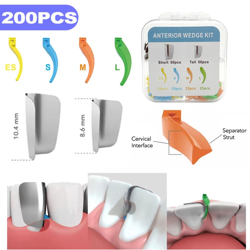 200Pcs Dental Supplies Anterior Matrix System Wedge Matrix Bands Interdental Wedges
