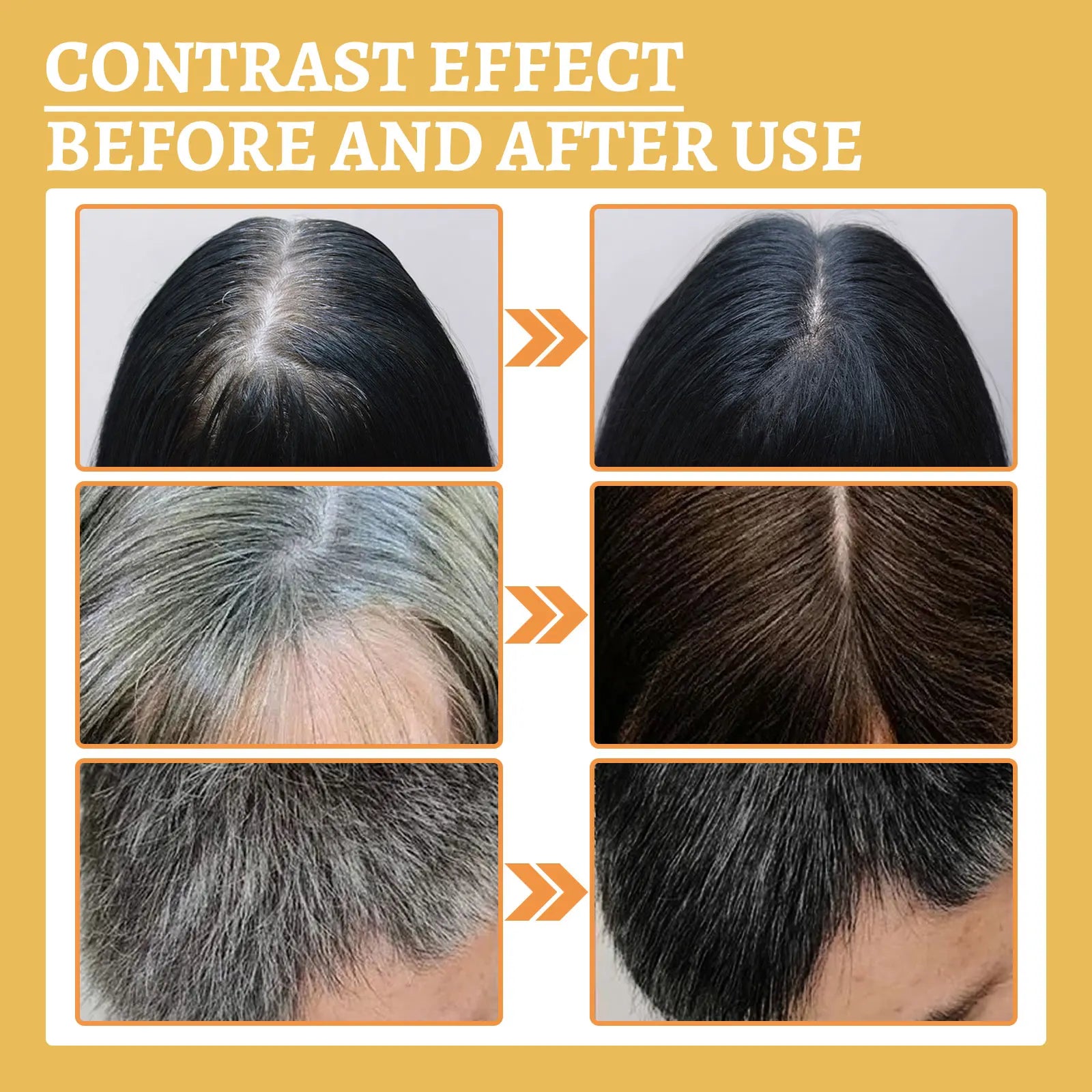 Reying Hair, Hair Darkening , Organic Ganoderma Nutrient Hair Reverse 30ML Black Ganoderma nourishes hair and strengthens it