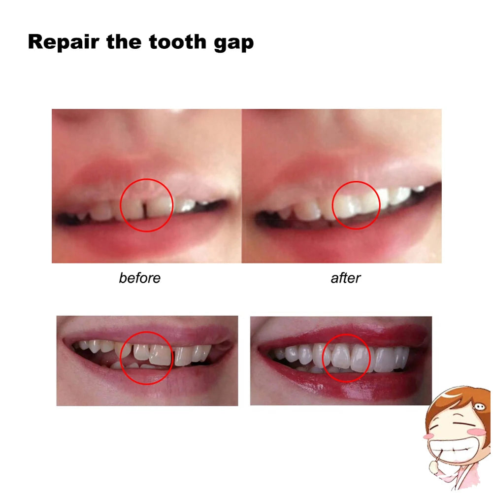 10/100g Dental Glue Handmade Solid Dental Restoration Kit Temporary Cavity Plugging Glue Practical Unisex Adults Teeth Whitening