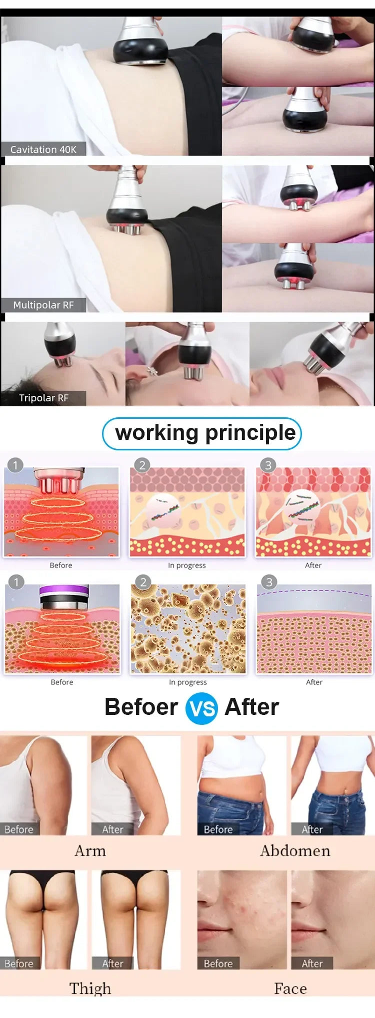 New 4 In 1 40k Cavitation Ultrasonic Body Care Tool