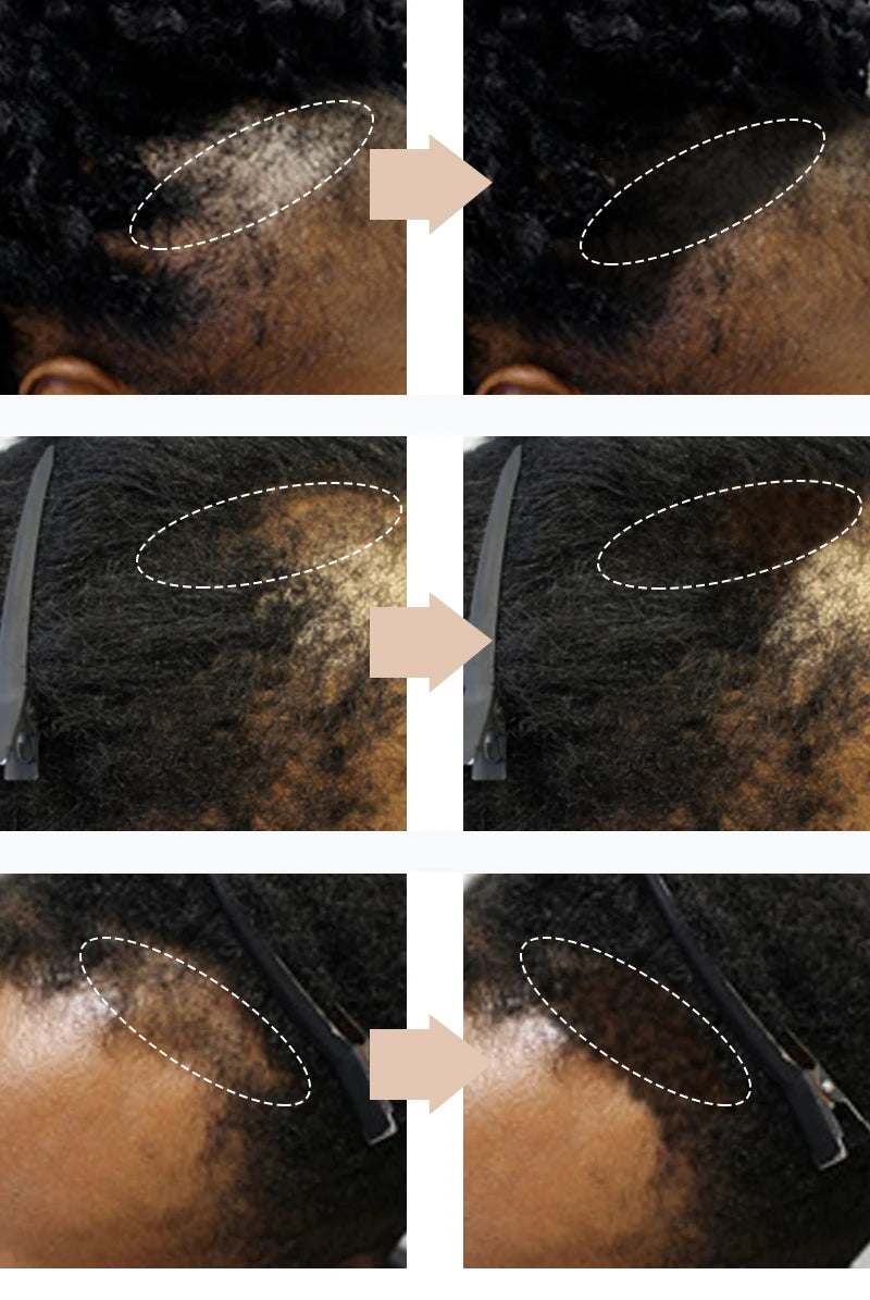 Sevich Waterproof Hair Line Powder 4g Natural Instant Hairline Shadow Powder Black Root Cover Up Forehead Hair Makeup Concealer