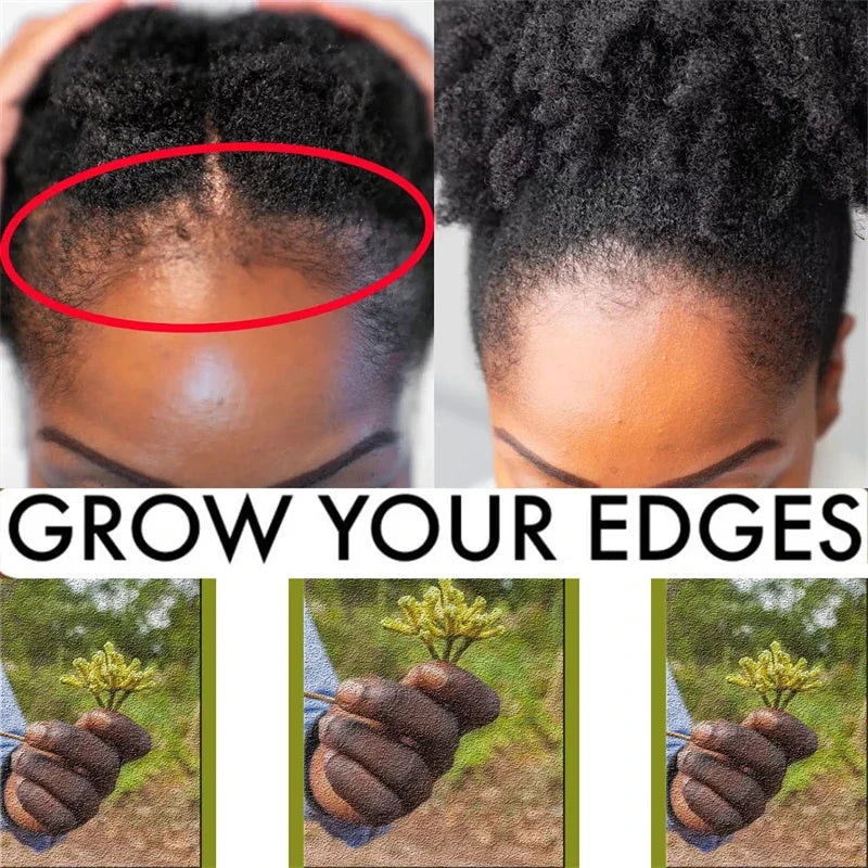 Africa Crazy Hair Edges Growth Traction Alopecia Chebe Powder Thicken Grow Long Hair Shampoo Hair Loss Treatment Wildly Beauty
