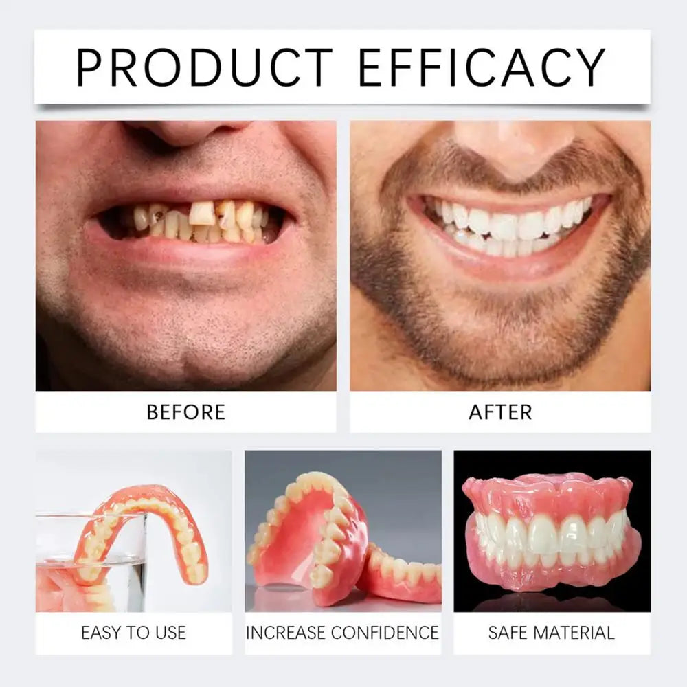 Denture Set False Teeth Top And Bottom Denture Solution Realistic False Teeth Professional Temporary Teeth Kit For Lovers