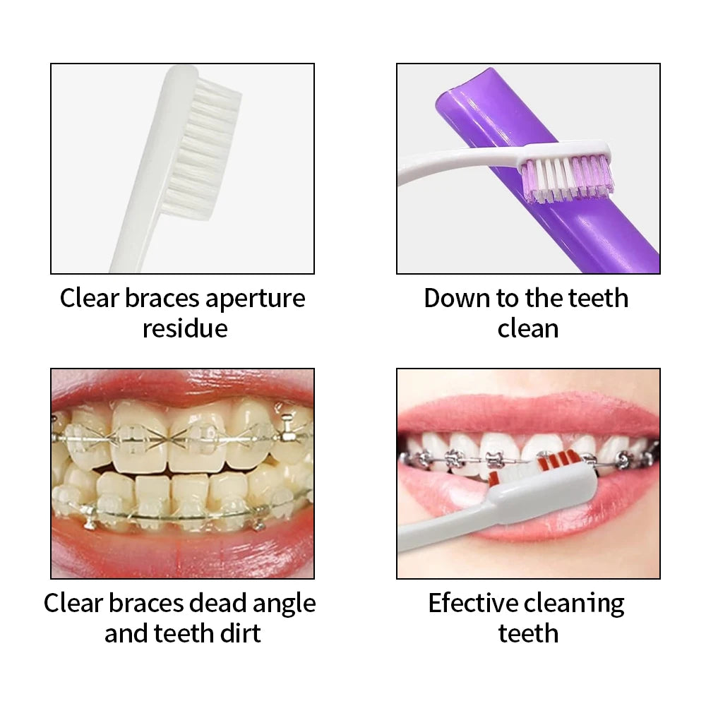 Dental Toothbrush Oral Care Kit Orthodontic Mirror Interdental Brush Supplies Cleaning Tools Ties Brush Floss Cleaning Braces