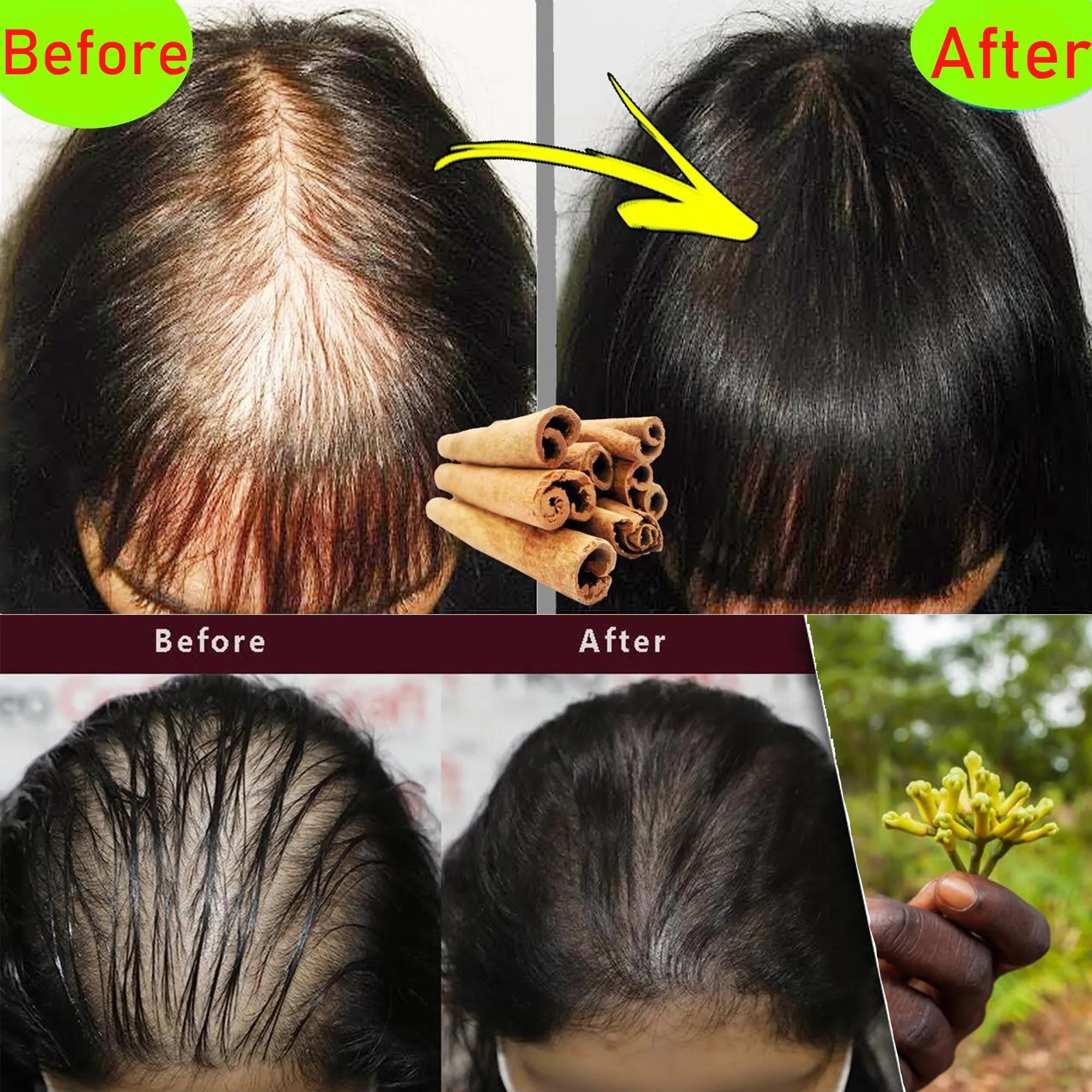 Africa Crazy Hair Edges Growth Traction Alopecia Chebe Powder Thicken Grow Long Hair Shampoo Hair Loss Treatment Wildly Beauty
