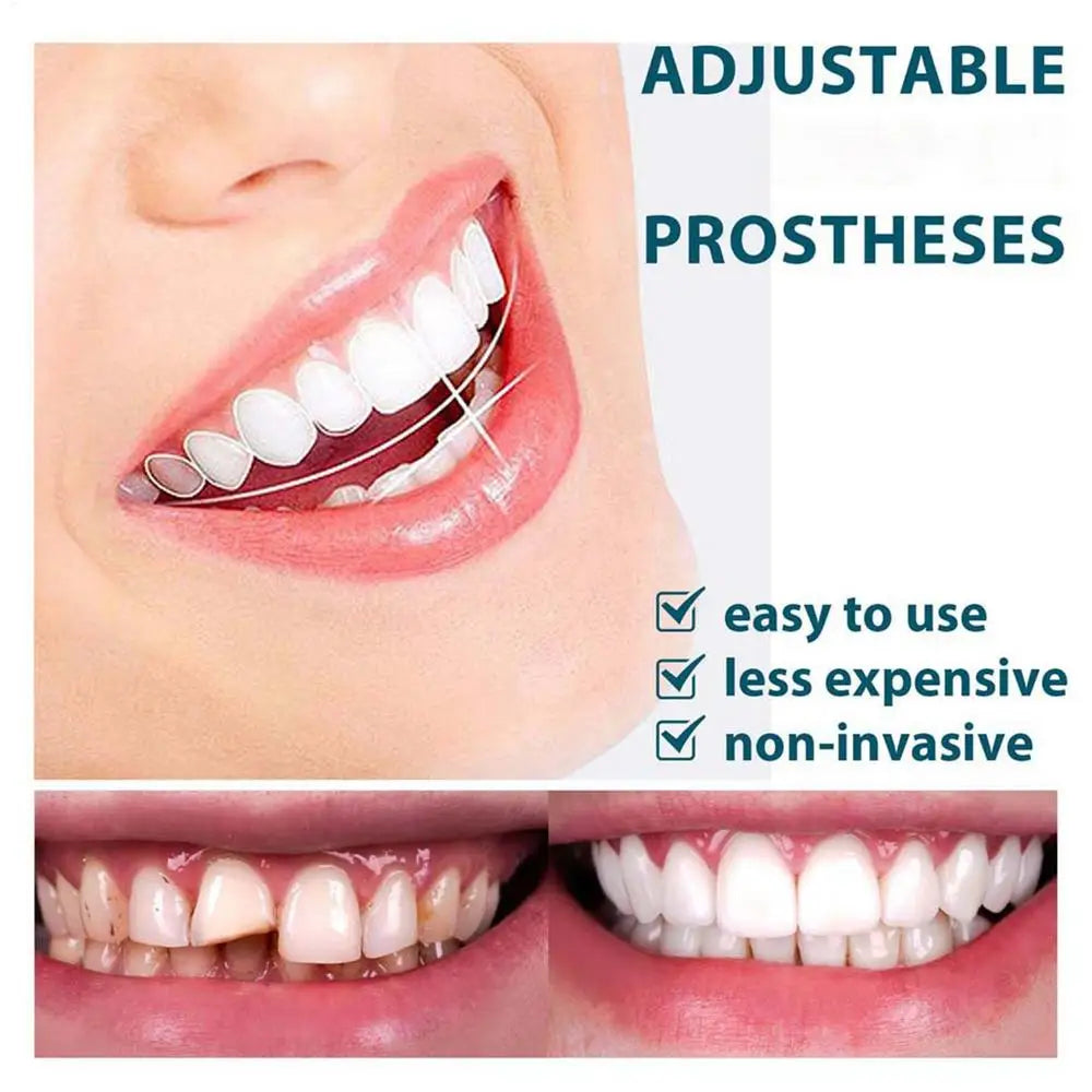 Veneer Snap On Teeth Kit Fake Tooth Cover Snap On,Teeth Fake Teeth Simulation Braces Veneers Dentures Cosmetic Fake Tooth Cover