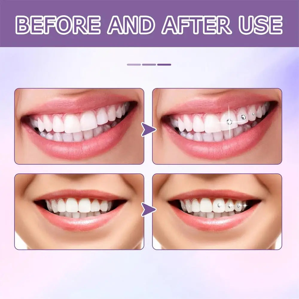 Dental Self-adhesive Gluel Tooth Gem Glue For Tooth Gems Diamond Kit Glue Teeth Crystal Jewelry Tooth Orthodontic Adhesive Gel