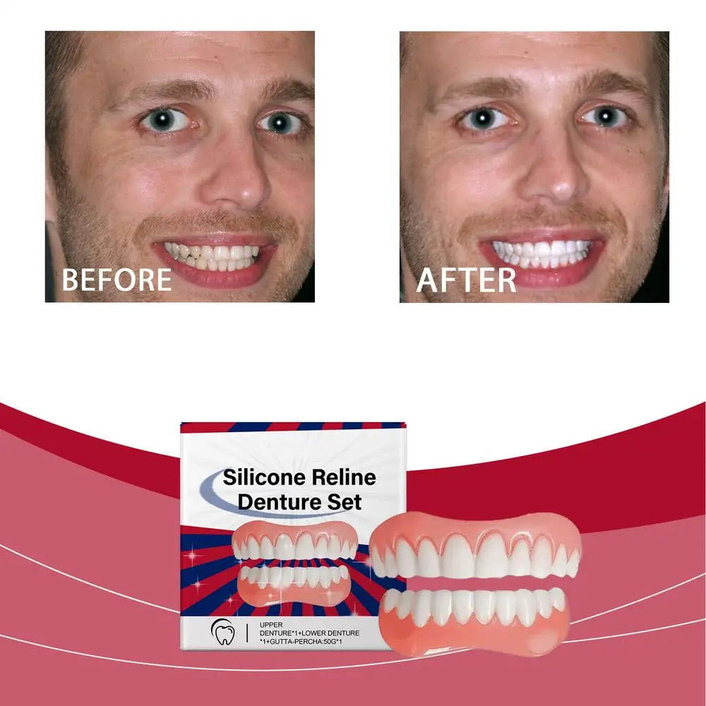 Silicone Denture Set Silicone Upper Lower Veneers Perfects Laugh Soft Denture Kit Denture Silicone Liners Soft Denture Kit