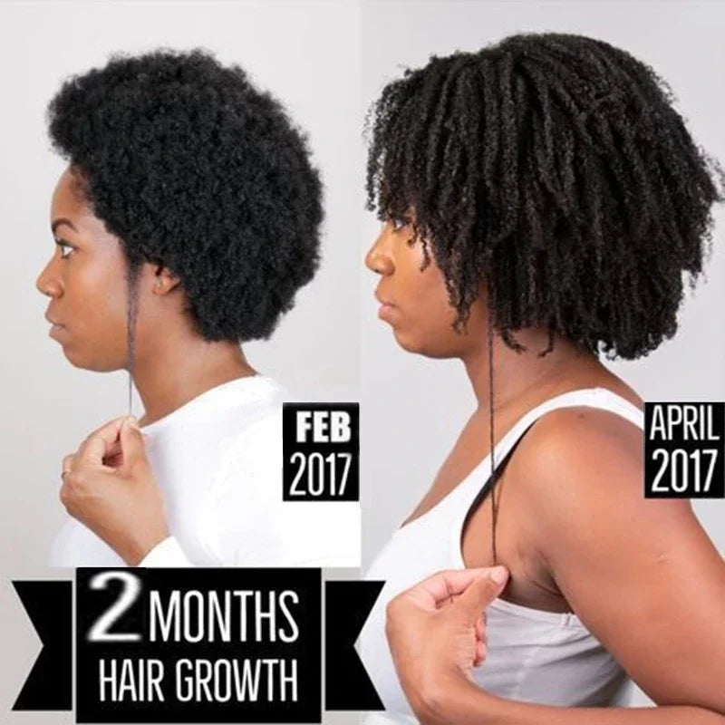 Africa Crazy Hair Edges Growth Traction Alopecia Chebe Powder Thicken Grow Long Hair Shampoo Hair Loss Treatment Wildly Beauty