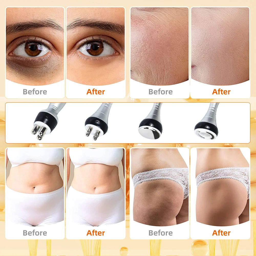 4 in 1 Vacuum Therapy Cavitation RF Radio Frequency Fat Remover Body Slimming Machine Ultrasonic Massage Shaping Instrument