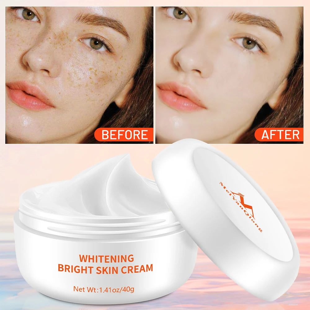 2pcs Meiyanqiong Anti Aging Face Care Cream Dark Spot Remover Skin Lightening Cream Dark Skin Care Anti Freckle Whitening Cream