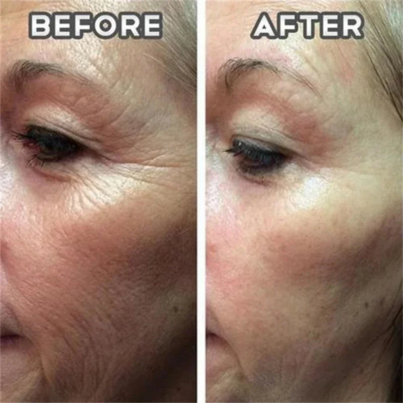 2pc Collagen Estrogen Female Hormones Oil,Remove Spots Wrinkle Eye Bags Anti-Aging,Breast Butt Enlargement,Skin Care for Women