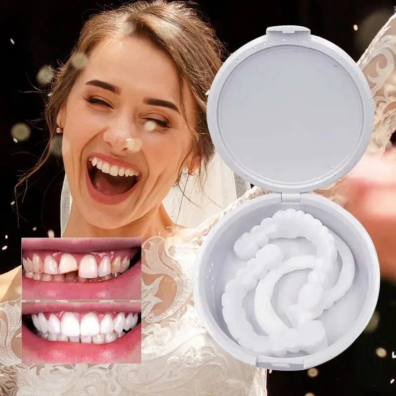 Veneer Snap On Teeth Kit Fake Tooth Cover Snap On,Teeth Fake Teeth Simulation Braces Veneers Dentures Cosmetic Fake Tooth Cover