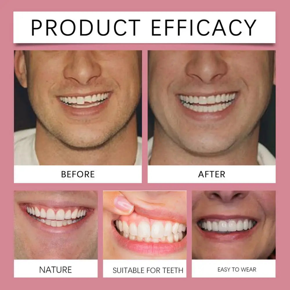 Silicone Denture Relines Kit Professional Denture Set Silicone Denture Set Portable Relines Prothese For Adults Women Men