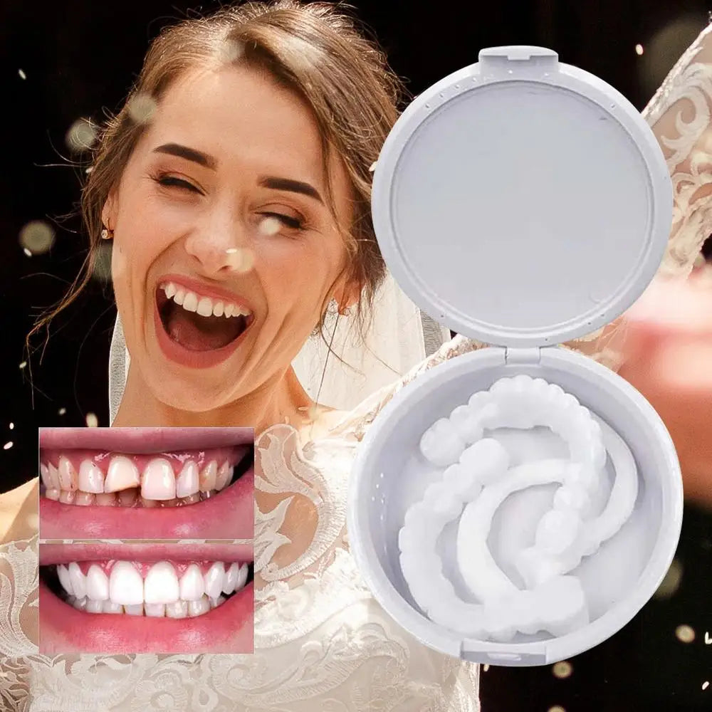 Veneer Snap On Teeth Kit Fake Tooth Cover Snap On,Teeth Fake Teeth Simulation Braces Veneers Dentures Cosmetic Fake Tooth Cover